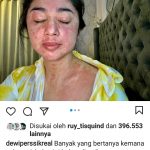 Akun IG Dewi Perssik