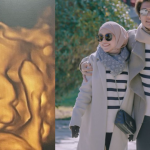 Lesti Kejora dan Rizky Billar Mulai Pamer USG Bayi