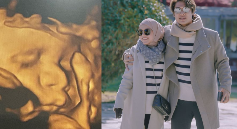 Lesti Kejora dan Rizky Billar Mulai Pamer USG Bayi