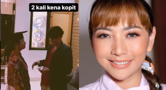 Hesti Purwadinata Wisuda Sembuh COVID-19 Dua Kali