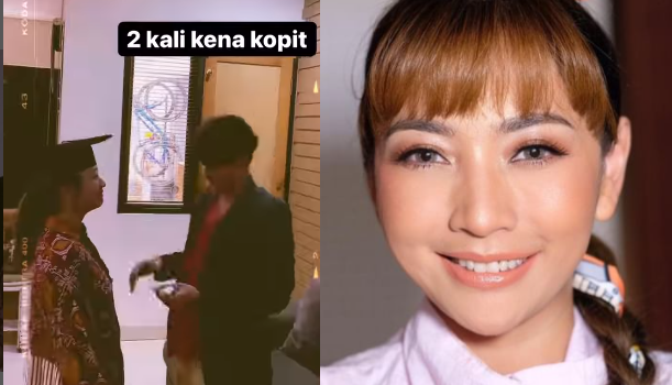 Hesti Purwadinata Wisuda Sembuh COVID-19 Dua Kali