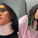 Sheryl Sheinafia Alami Saraf Kejepit, Begini Kebiasannya