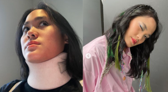 Sheryl Sheinafia Alami Saraf Kejepit, Begini Kebiasannya