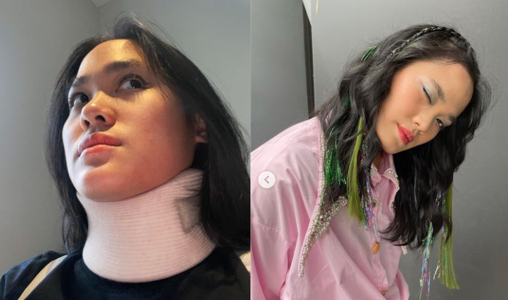 Sheryl Sheinafia Alami Saraf Kejepit, Begini Kebiasannya