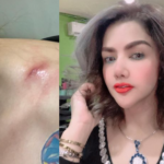 Barbie Kumalasari Dijambret, Liontin Rp400 Juta Raib