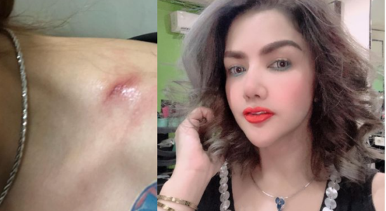 Barbie Kumalasari Dijambret, Liontin Rp400 Juta Raib