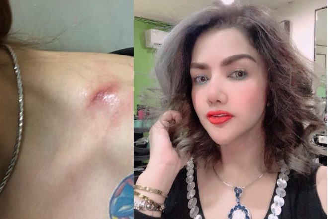 Barbie Kumalasari Dijambret, Liontin Rp400 Juta Raib